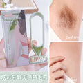 Colorful fenling non-sensory armpit hair knife body care shaving knife macro protective net classy professional anti-scratch leg shaving knife