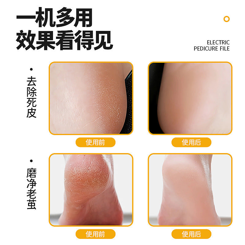 New USB rechargeable electric foot grinder waterproof callus removal foot trimmer foot grinder dead skin removal foot trimmer