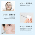 Keqi acne needle oem processing to squeeze acne and blackheads stainless steel acne needle oem oem packaging odm