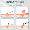 Oem in stock stainless steel acne clip suit acne needle cell clip squeeze blackhead remove acne acne tweezers tool