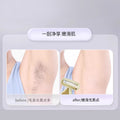 Keqi shaving knife processing personalizedsummer whole body hair removal instrument oem macro armpit hair knife shaving leg hair oem